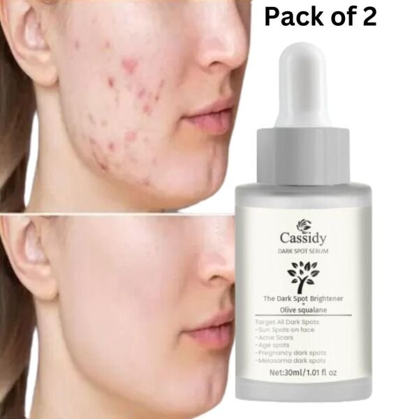 Cassidy Dark Spot Serum Dark Spot Brightener And Olive Squalane Remove Acne Scars (Pack Of 2) - Image 3