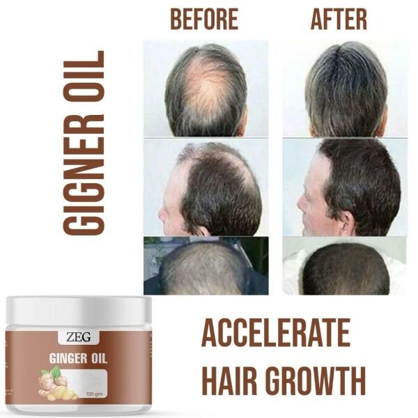 Zeg Ginger Oil 100gm 100% Natural Multipurpose Oil For Hair Skin & Body (Pack Of 2) - Image 3