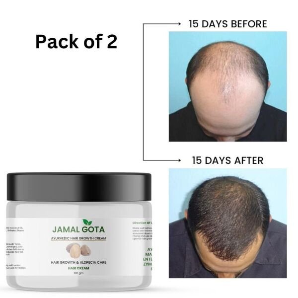 Jamalgota Ayurvedic Hair Growth Cream 100gm (Pack Of 2) - Image 3